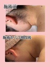 メゾン ミニョンヌ(maison mignonne)/ビフォーアフター