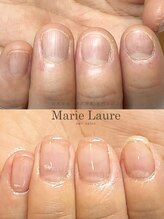 マリーロール 梅田店(Marie Laure)/自爪育成/深爪矯正/ネイルケア