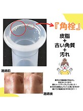 ミスズ(MISUZU)/毛穴