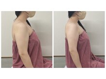 ブリランテ(Brillante)/