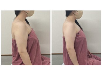 ブリランテ(Brillante)/