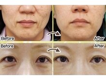 リーフの雰囲気（9種類の美容成分をオ-ダ-メイドで配合し、お悩みを劇的に改善◎）