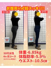 はぴねす整骨院/50代女性