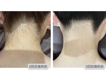 メンテナンス(Maintenance)の雰囲気（ワックス/光脱毛でさらに美しい肌に☆1回目で実感する方多数☆）