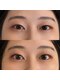 【まつ毛/眉毛専門店】 minminの写真/思い通りに上がらない・左右差でお悩みの方へ