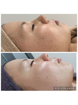 ビラ ベルダ(Bira Beldad)/