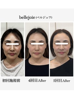 ベルジュワ(bellejoie)/