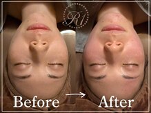 R-1ビューティーサロン 表参道/Before&After