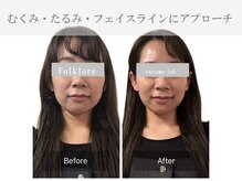 フォルクローレ エクソソーム ラボ(folklore exosome lab.)