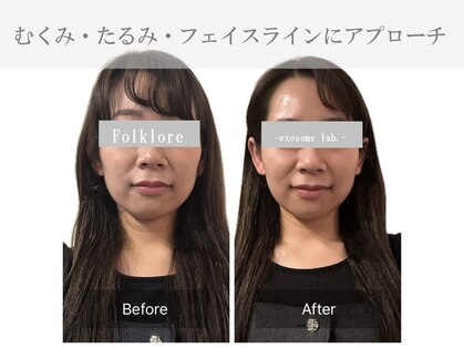 フォルクローレ エクソソーム ラボ(folklore exosome lab.)の写真