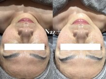 リベルテ(Liberte)/セレクト艶肌管理