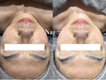 リベルテ(Liberte)/セレクト艶肌管理