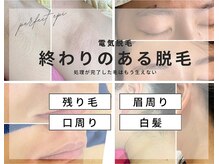 パーフェクト エピ(PERFECT EPI)