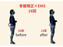 リボーン(REBORN)/整体/骨盤矯正/EMS