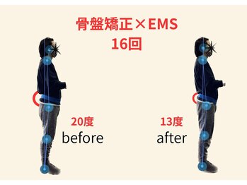 リボーン(REBORN)/整体/骨盤矯正/EMS