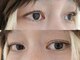 ネストアイ(NEST eye)の写真