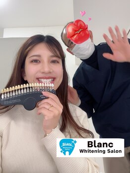ブラン 心斎橋店(Blanc)/歯が白くなると笑顔が増えます