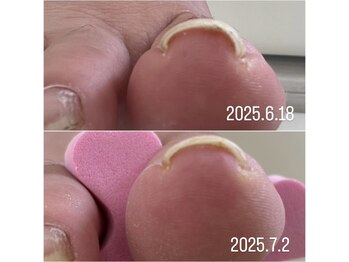 ケア ビューティー ネイル(care beauty NAIL)/
