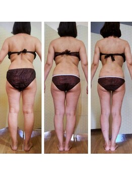 ノーリーン(NOLEEYN)/痩身コンテスト準グランプリ受賞