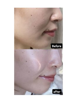 ディサイドロー(DECIDE L.A.W)/BeforeAfter