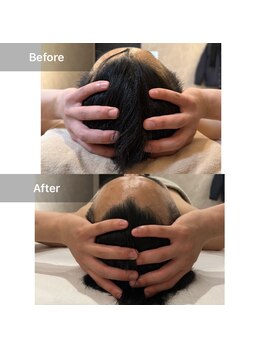 ルネアススパ 南青山(Lune’as Spa)/ドライヘッドスパ