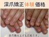 【深爪/噛み爪】新生活応援キャンペーン☆長さを出す深爪矯正初回体験