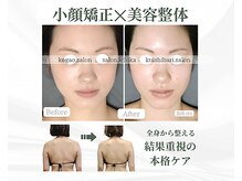 イチカ 仙川店( ichika)の雰囲気（小顔矯正×美容整体）