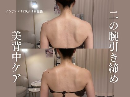 ミーティスの写真