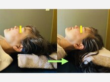 香音堂(カノンドウ)/【小顔/むくみ】の改善