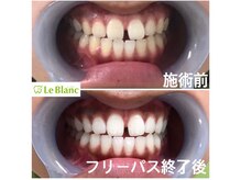 ルブラン 奈良店(Le Blanc)/サロン選び重要です！