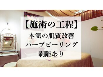 ラビエス(LAVIES)/ハーブピーリング|剥離◎施術