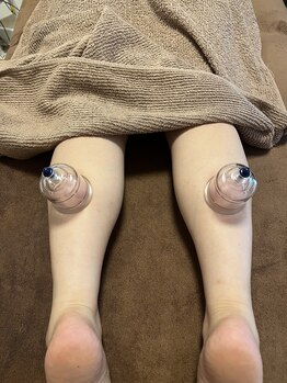 マル(malu)/カッピング