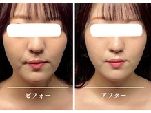 クク 赤坂 天神(99 KUKU)/