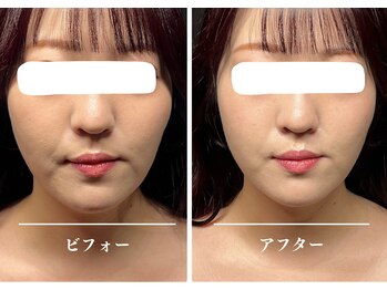 クク 赤坂 天神(99 KUKU)/