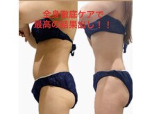 3回のビフォーアフター！独自の技で最高のボディに導きます！
