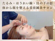 ブルースター