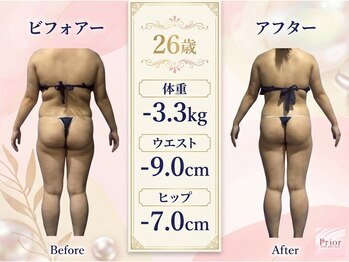 セラピアの写真/熟練リンパマッサージでリンパの流れを改善し老廃物排出を促進する痩身メニュー☆代謝UP＆徹底デトックス！