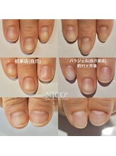 ニコプラス(NICO+)/