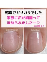 ミミ(mimi)/家族に褒められる爪！