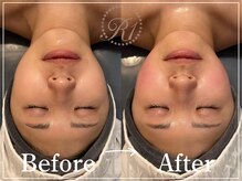 R-1ビューティーサロン 表参道/Before&After
