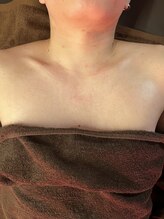 ロアー 赤坂店(RAWR)/デコルテマッサージ♪