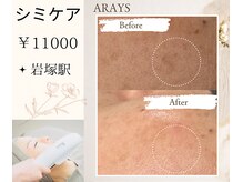 アレイズ(ARAYS)