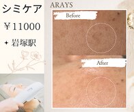 アレイズ(ARAYS)