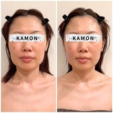 カモン(KAMON)