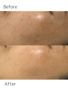 リュクス Luxe+tkm 南船場/セラピールビフォーアフター