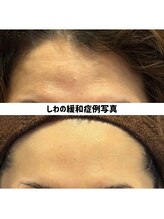 リジェ(Rege)/50代女性の方　施術