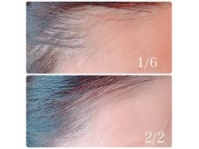 カレント(current)の雰囲気（次世代の頭皮スカルプ再生ケア）