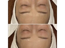 トータルエステティック ジョワイユ(JOYEUX)/【50代から変わる】お肌管理育成