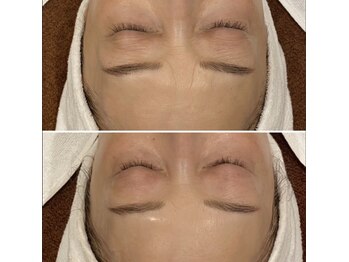 トータルエステティック ジョワイユ(JOYEUX)/【50代から変わる】お肌管理育成