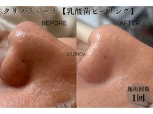 エレンシア(E'lencia)の雰囲気（１回で変化実感！【毛穴撲滅】乳酸菌ピーリングで鎮静＋毛穴レス）